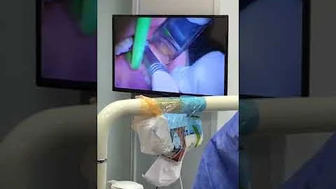 Live Impaction with Prof mohamed shuman