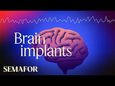A major breakthrough in brain implants