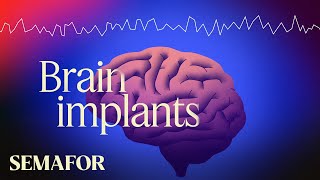 A major breakthrough in brain implants
