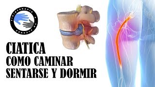 Ciatica por hernia discal, como caminar, sentarse y dormir para aliviar el dolor