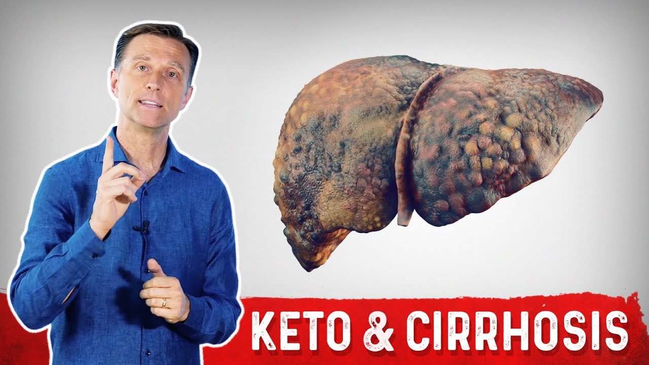 Can Keto (Ketogenic Diet) Help Cirrhosis of the Liver? YouTube