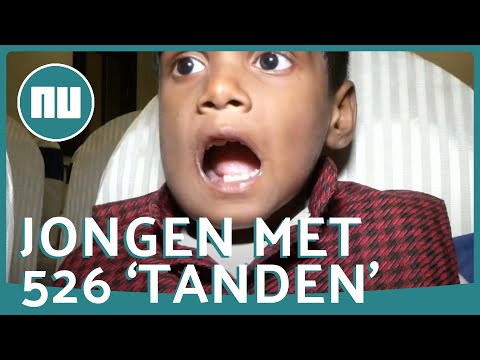 Video: In India Werden Bij Een Zevenjarige Jongen 80 Extra Tanden Verwijderd - - Alternatieve Mening