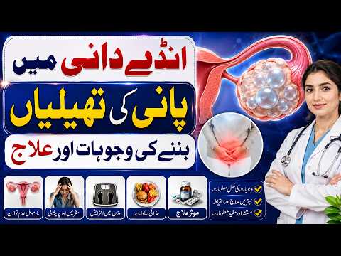 Cyst in Ovary Causes Treatment- Cyst Kya Hota- Cyst Ka ilaj - Ovarian Cyst Treatment- Ovarian Cancer