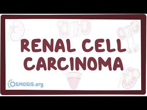 Renal cell carcinoma - an Osmosis Preview