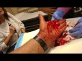 Worst Monitor Lizard Bite !