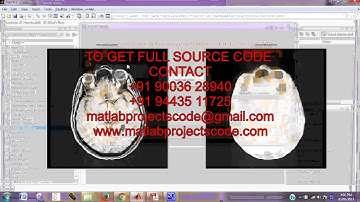 The Connected Brain:Causality, models, and intrinsic dynamics