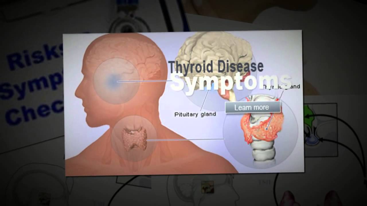 Thyroid and Sleep Hyperthyroidism YouTube