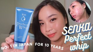 SENKA PERFECT WHIP CLEANSER REVIEW for ACNE PRONE SKIN - Maganda ba