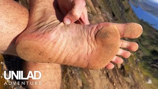 How I Transformed My Feet By Going Barefoot 😲👣  | UNILAD Adventure