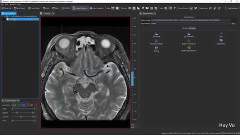 How to annotate DICOM images using MITK | Harry