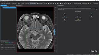 How to annotate DICOM images using MITK | Harry's Vlog