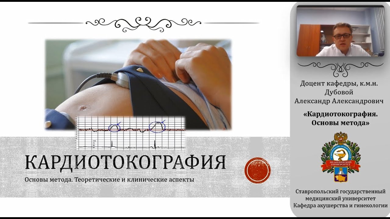Кардиотокография. Основы метода