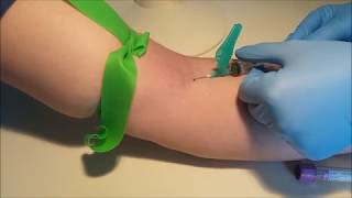 Extracción dvt brazo de de sangre en el la después