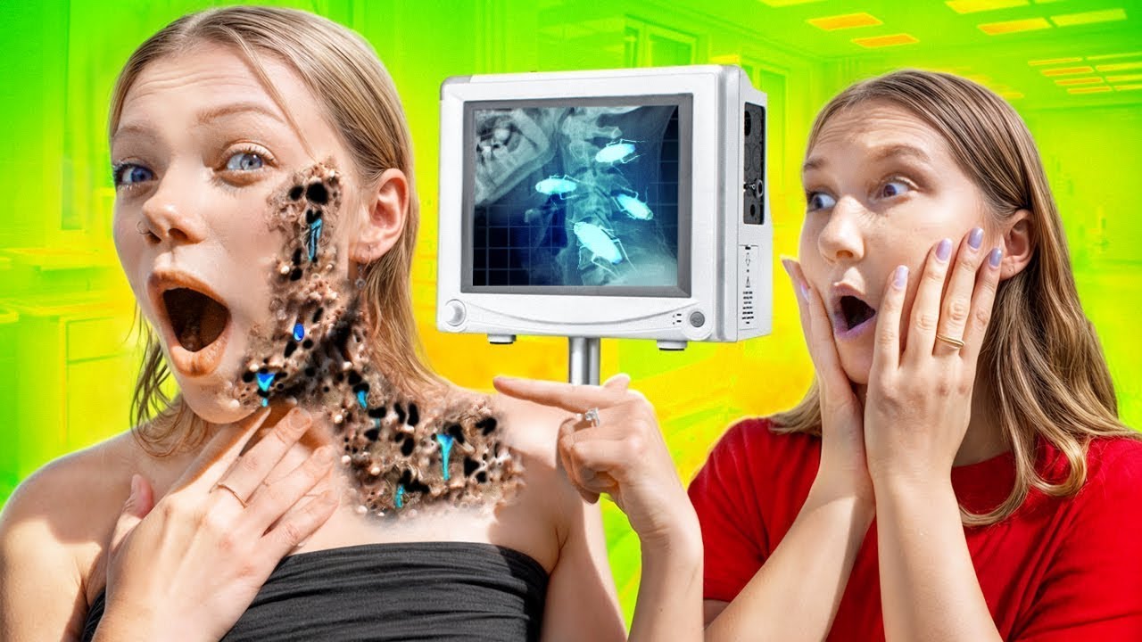 Ma Copine A UNE MALADIE TERRIBLE! Que Faire Si Elle Ne Peut Pas S'Aider Elle-Même? 😷🤒 Caramelkins