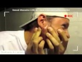 Popping A Huge Sebaceous Cyst Barbara A Lamm Popping A Huge Sebaceous Cyst Barbara A Lamm