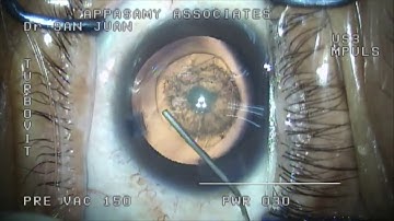 Hydrodissection and Hydrodelineation