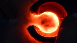 traitement des varices par Veinelite LED(nouvelle appareil de traitement des varices profonde., 2016-11-19T19:11:05.000Z)