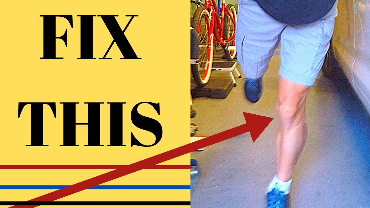 How to COMPLETELY Repair Chondromalacia Patella 💥3 Steps💥 YouTube