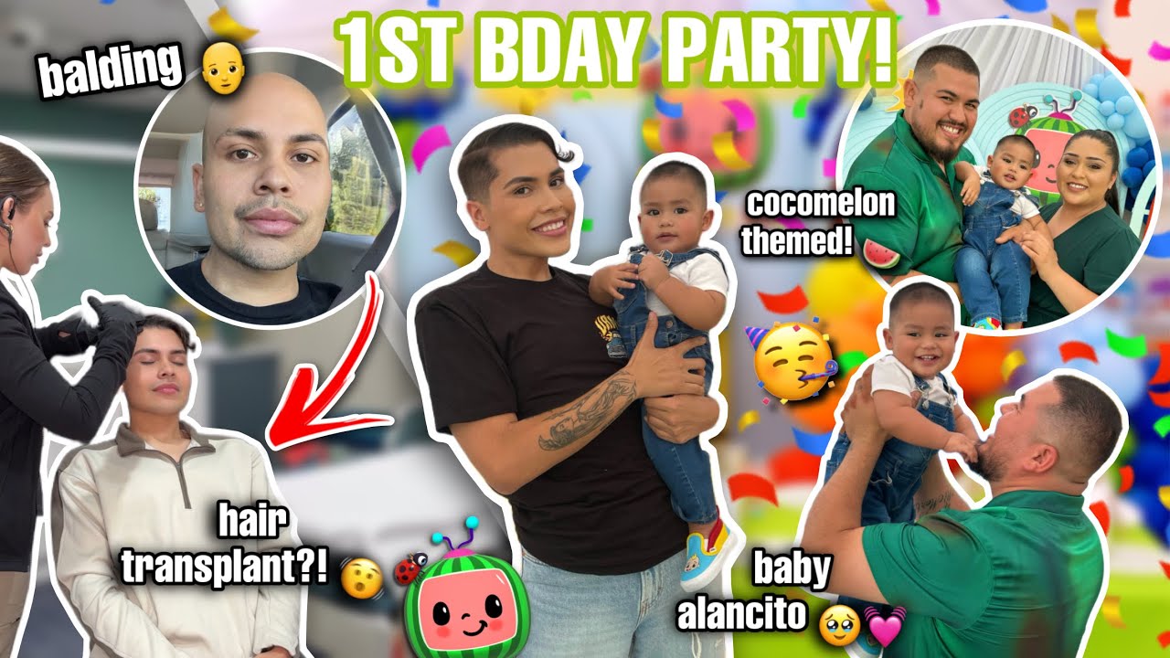 Hair Transplant?! + Baby Alancito's 1st Birthday Party Vlog! - YouTube