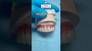 All-on-X try-in#dentist#parati#dentaltech#shorts#passion#satisfying#cesar#reels#viral#yt#fyp#diy