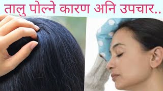 तालु किन पोल्छ|Head burning in Nepali|Dr Bhupendra Shah|doctor sathi