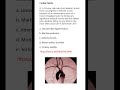 Medicine & Surgery MCQs (For MBBS, USMLE, MCCQE & PLAB)