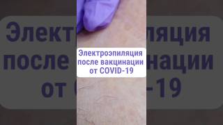 Электроэпиляция после вакцинации от COVID-19