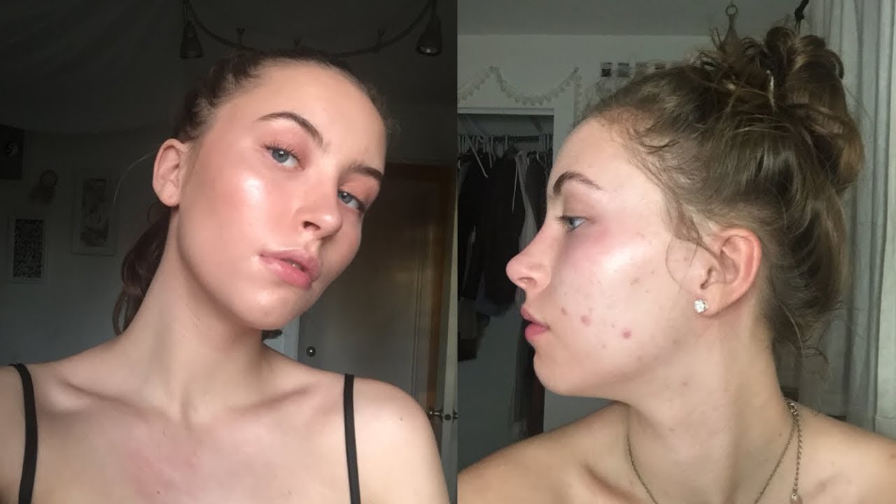 skin care routine 2017 // acne prone - YouTube