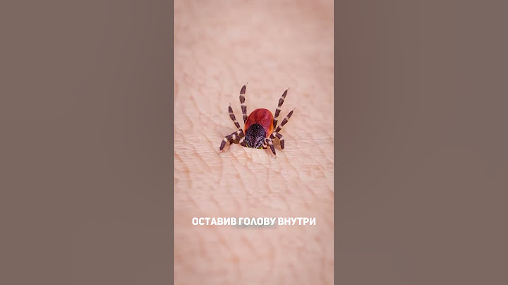 Как удалить клеща 🤢#клещи #удалитьклеща #жизненно #знаетеливычто #каждому #клещ #будьлучше #важное