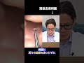 耳の粉瘤久々に綺麗に取れて皮膚科大絶賛#shorts