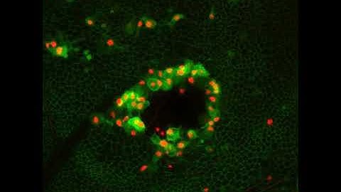 Repair and regeneration: how cells repair and replace themselves – Video 2