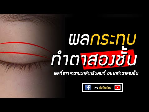 โหงวเฮ้งน่ารู้ :ผลกระทบของการทำตาสองชั้น | โหงวเฮ้ง ตาสองชั้น (พิจารณาก่อนทำ)