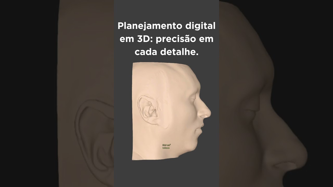 Como a tecnologia pode mudar sua cirurgia ortognática?