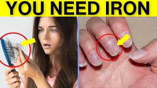 10 Signs of Iron Deficiency to Never Ignore | Iron Deficiency Anemia