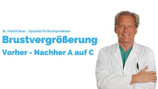 VORHER - NACHHER l 6 WOCHEN NACH MEINER BRUST OP