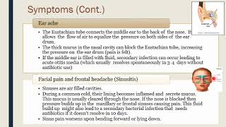 Common Cold  Influenza  Cough  - community pharmacy صيدلة المجتمع