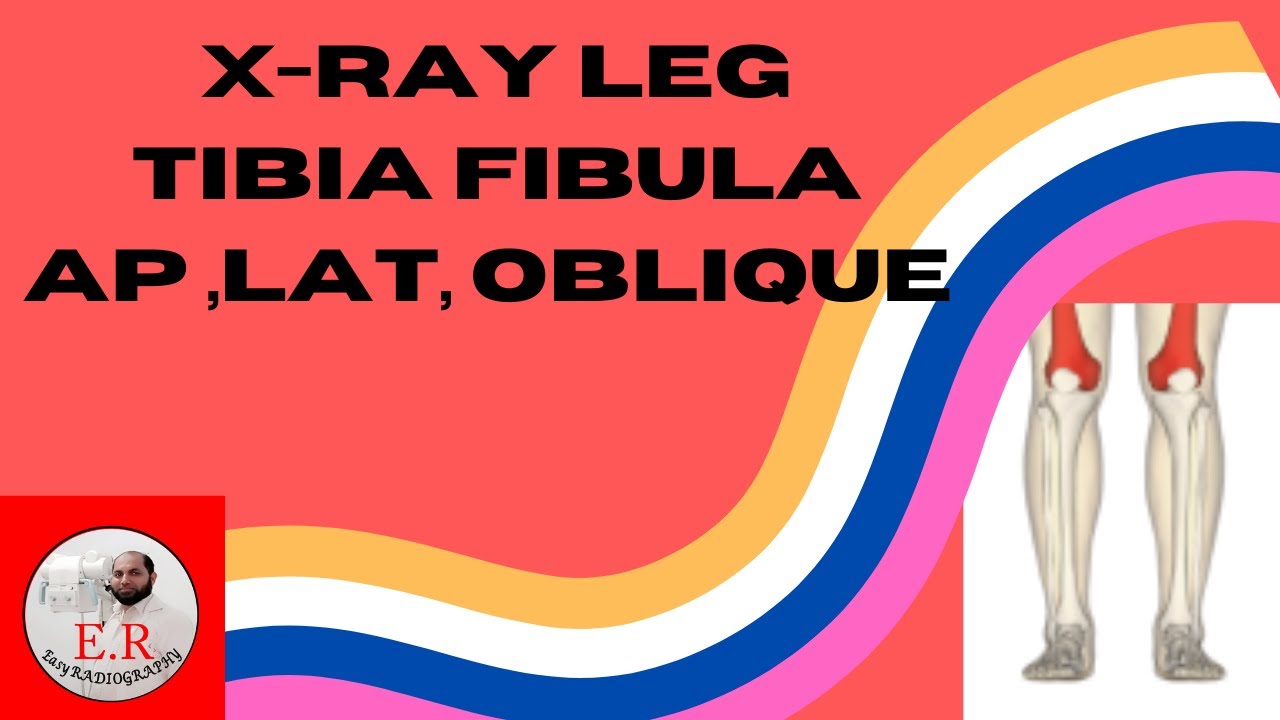 X-ray Leg|x-ray Tibia Fibula|#AP|#Lat\In Urdu|Hindi| EASY RADIOGRAPHY