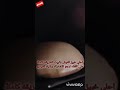 روتين نار خبيز العيش المرحرح خطير 