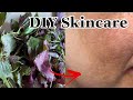 DIY Skincare #2 - Cách Trị Nám Bằng lá Tía Tô - Xóa Mờ Nám Tàn Nhang Lâu Năm