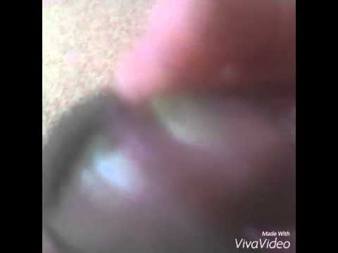 MV