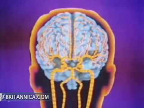 Video: Welk deel van de hersenen is beschadigd door een beroerte?
