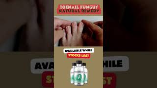 Natural Remedy: Toe Nail Fungus Cure onychomycosis howtocurenailfungus fungalinfection