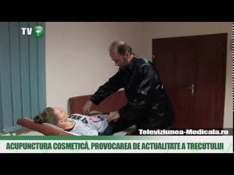 acupunctura penisului