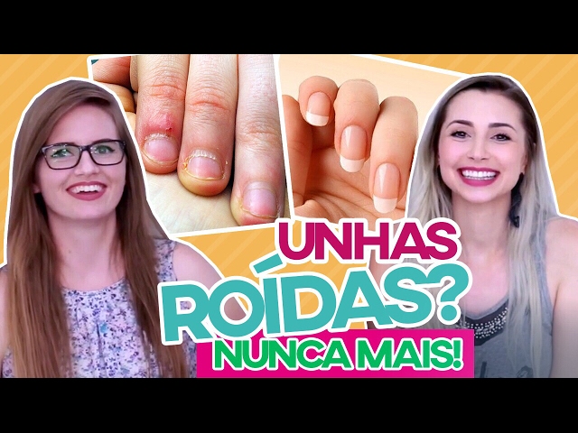 Como parar de roer as unhas! Dicas & truques! - Unha Bonita