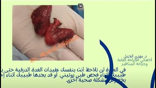 درنات الغدة_الدرقية - Thyroid nodules  - د. مهدي_الجمل - أخصائي الجراحة العامة وجراحة المناظير