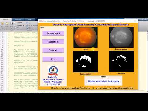 Diabetic Retinopathy Detection using Convolutional neural network CNN Matlab Source Code