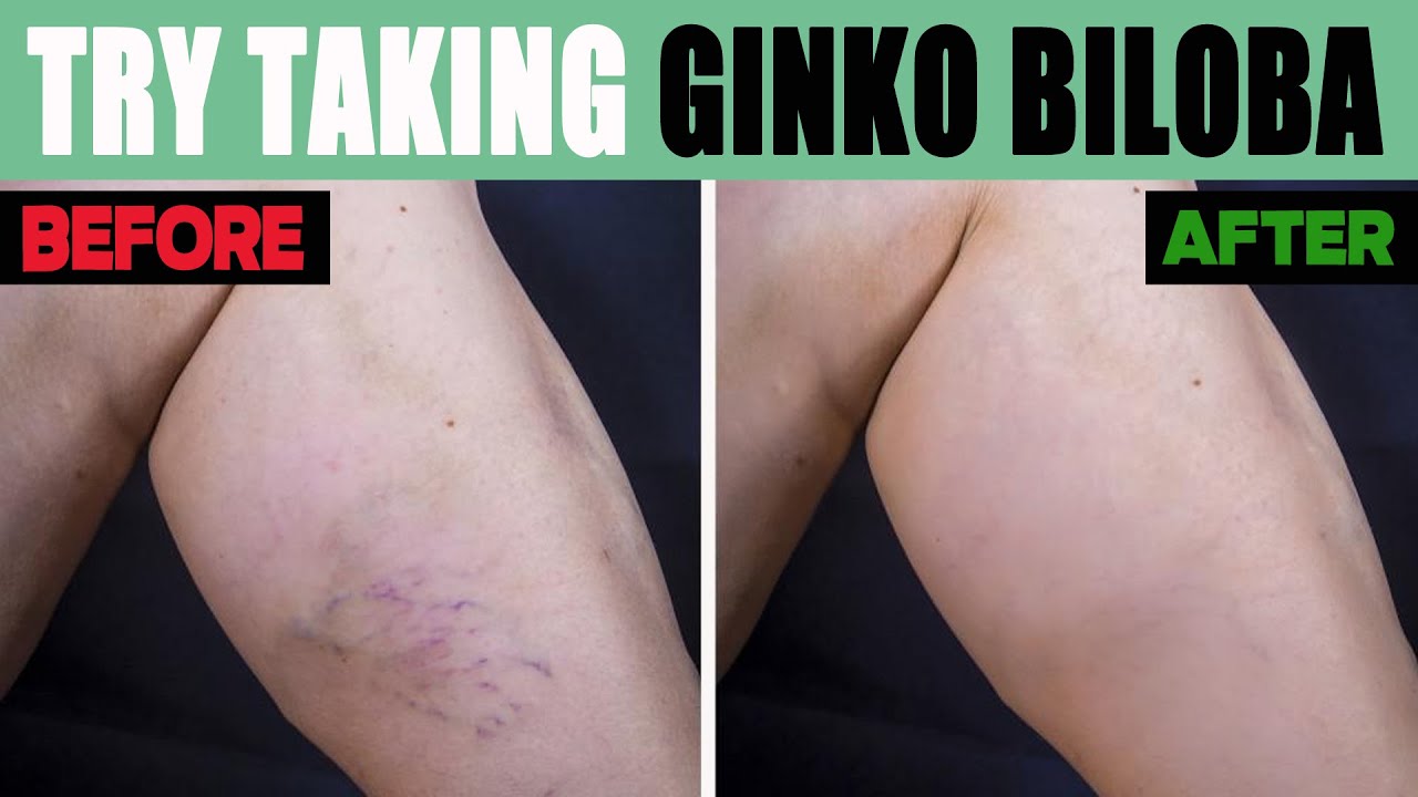 Ginkgo Biloba A Miracle Herb for Diabetes, Heart Problems and