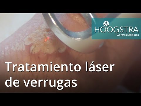 lesiones cutáneas definicion Tratamiento láser de verrugas (17105)