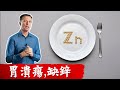 胃潰瘍原因 鋅不足與自然療法 柏格醫生 Dr Berg 胃潰瘍原因 鋅不足與自然療法 柏格醫生 Dr Berg
