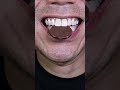 ASMR | Chocolate Coin CRUNCH! 🪙🍫 #DoctorTristanPeh #ASMR